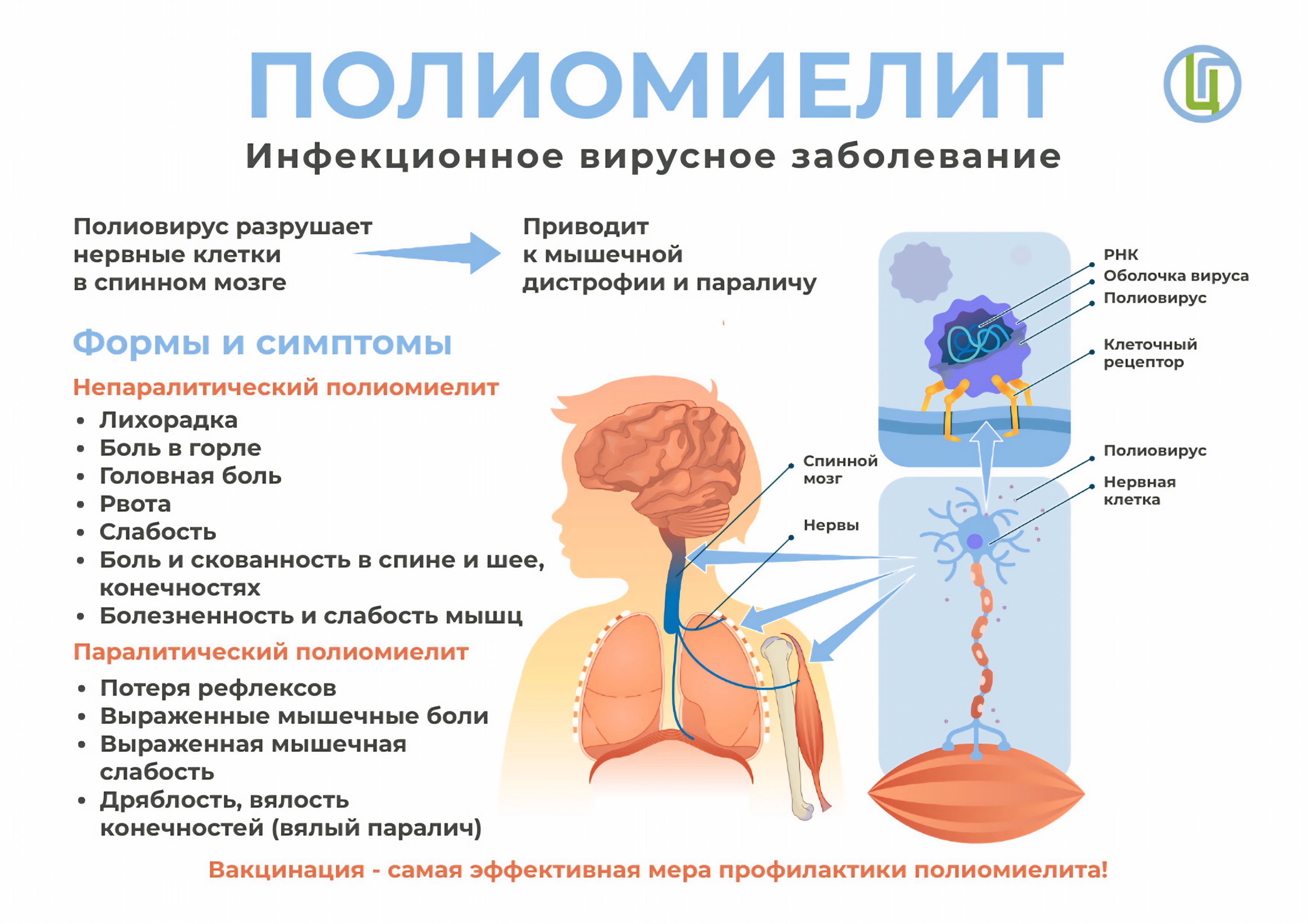 Профилактика полиомиелита.